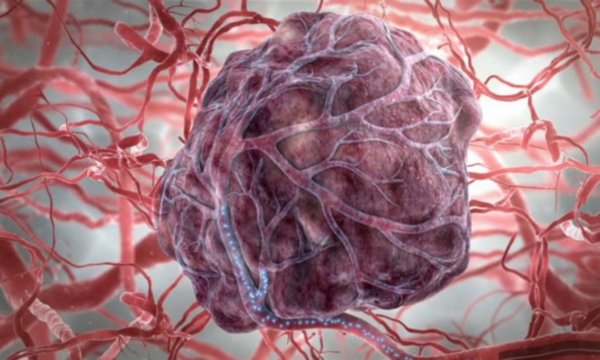 Ученые нашли метод ранней диагностики рака