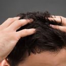 Ученые раскрыли истинную причину появления перхоти